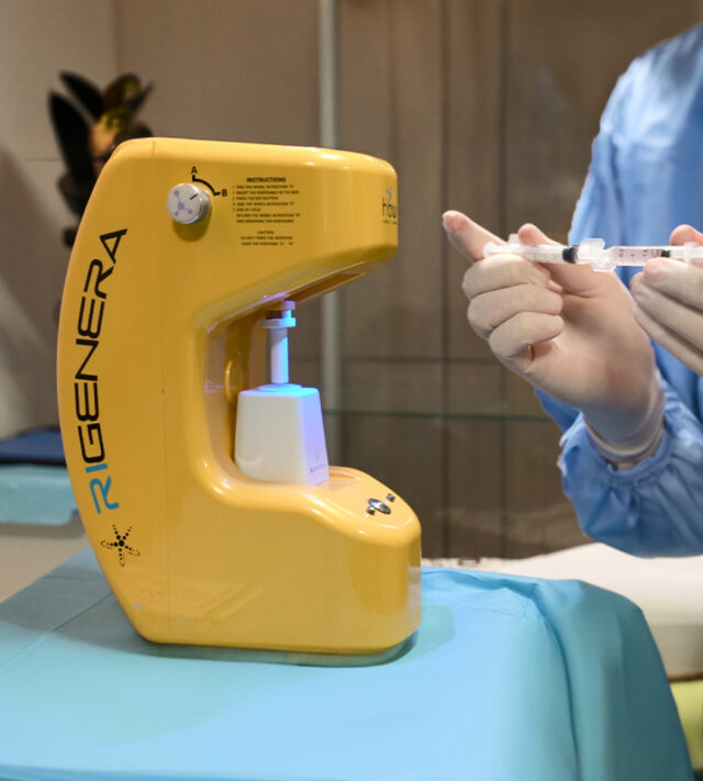 Stem Cell Hair Therapy