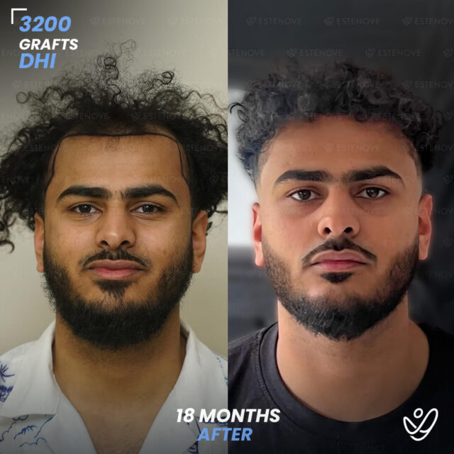 Hossam - 1