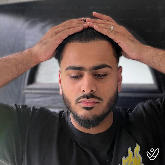 Hossam after - 2