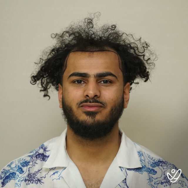 Hossam before - 1