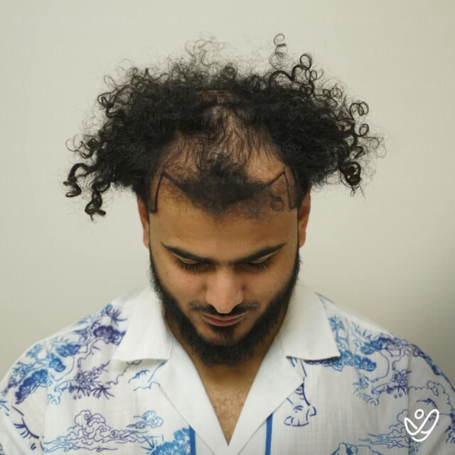Hossam before - 2
